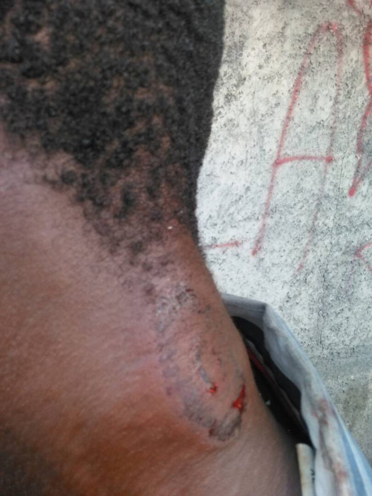 Port Au Prince - Um trabalhador em greve recebeu uma bala de borracha no pescoço.